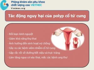 Những dấu hiệu và tác hại của polyp cổ tử cung ở nữ giới